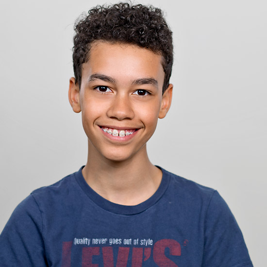 L'orthodontie vestibulaire